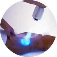 Localized Cryo