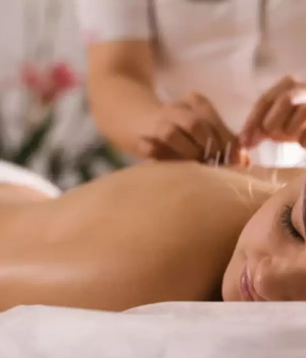 Acupuncture